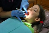 Dental Exam Stock Images