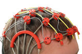 Epilepsy examination Stock Photo